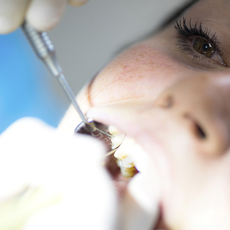 cura parodontite sondrio