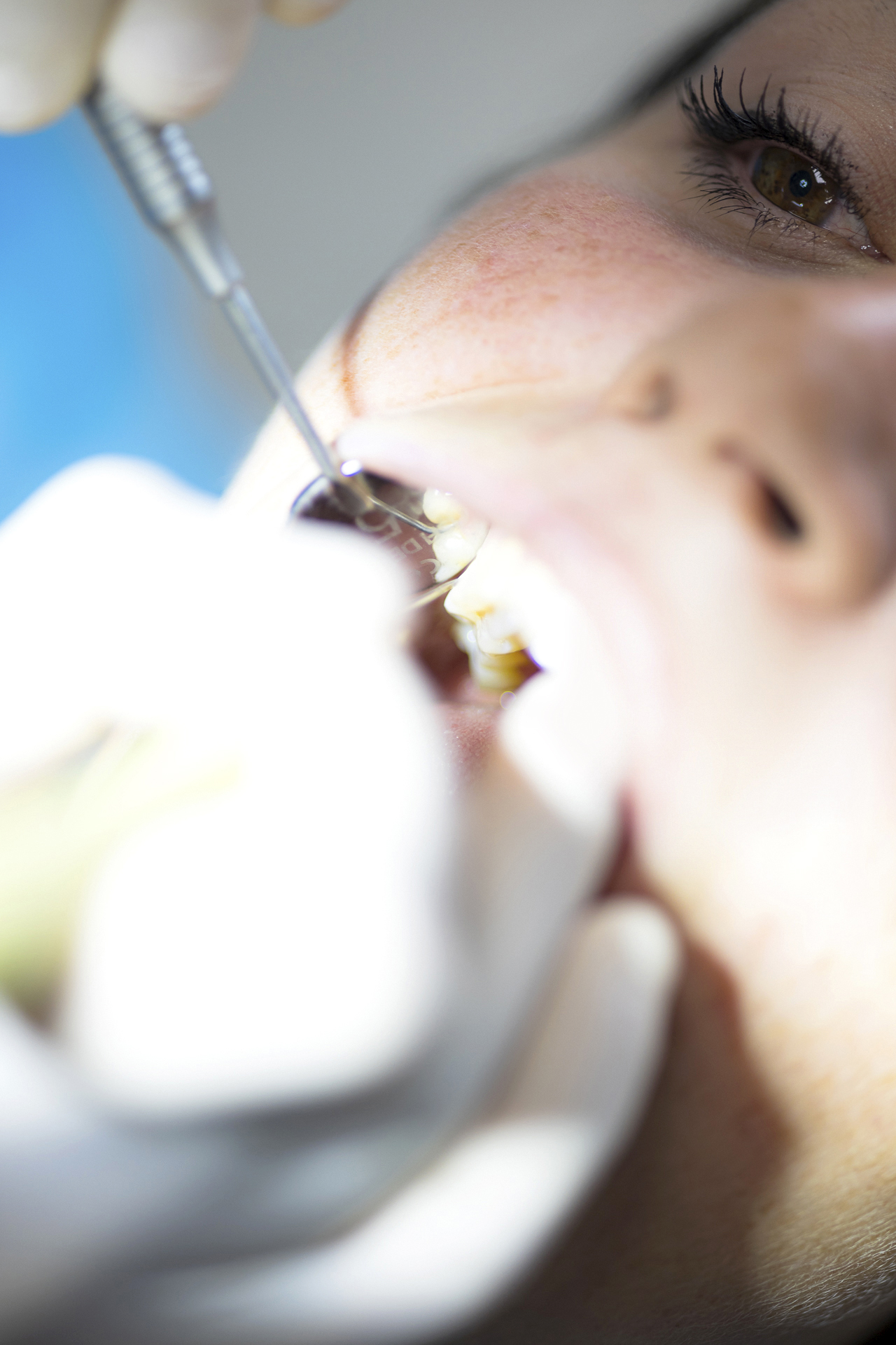 cura parodontite sondrio