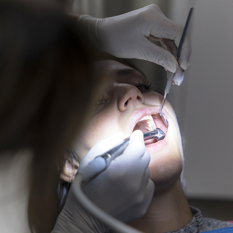 otturazione carie sondrio